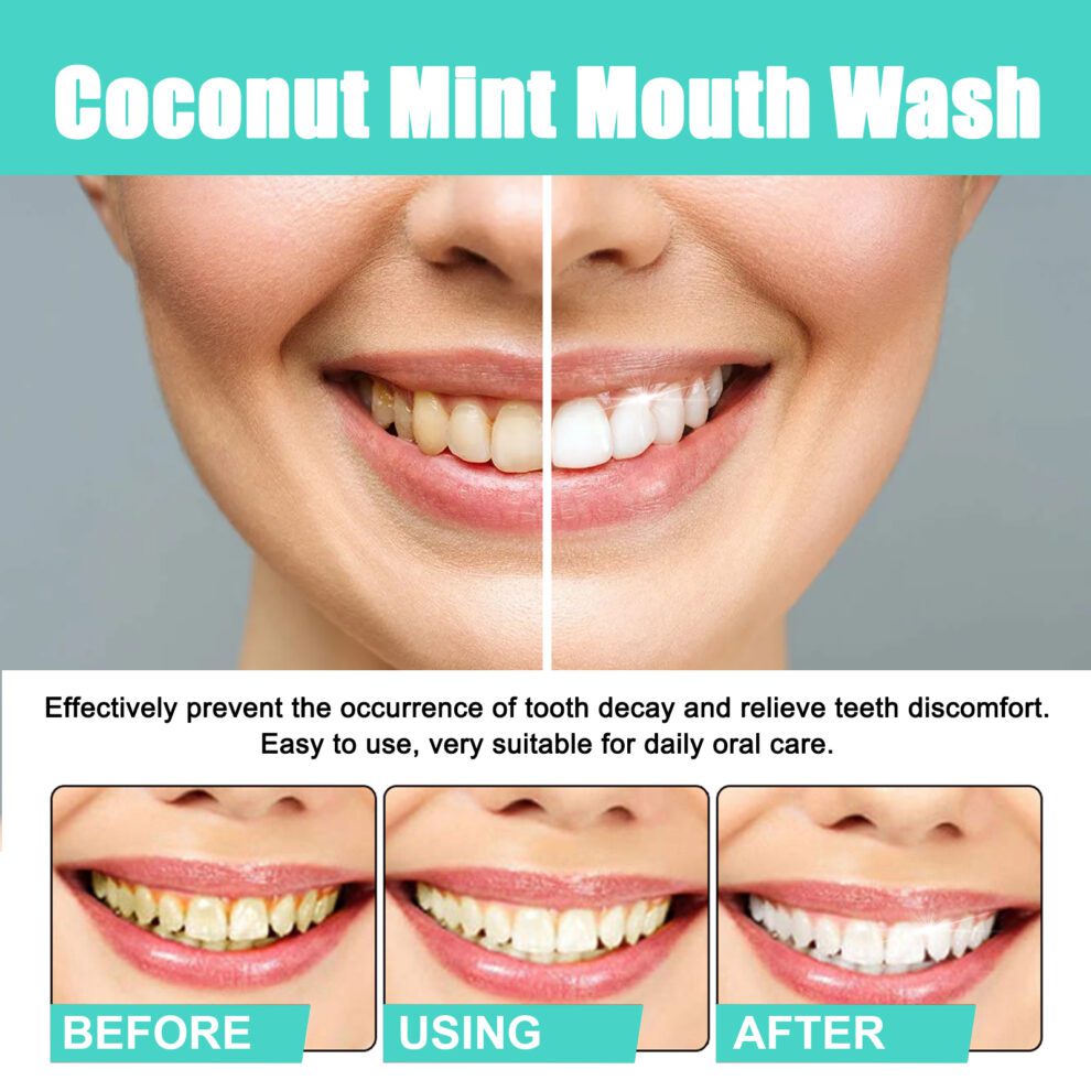 Coconut Mint Daily Mouthwash - Fresh Breath, Natural Care & Comfort - Image 4
