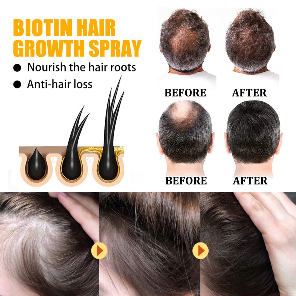 EELHOE Biotin Hair Spray - Daily Care for Soft Shiny Hair - Image 4