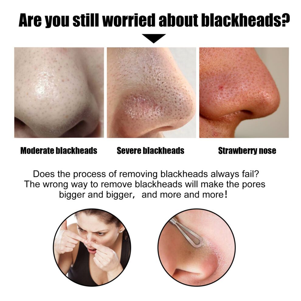 EELHOE Black Pig Nose Mask Patch, Bamboo Charcoal Gentle Daily Care - Image 3