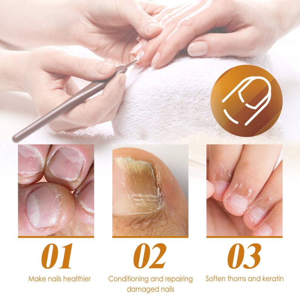 EELHOE Cuticle Care Gel: Aloe & Vitamin E for Soft, Healthy Nails - Image 6