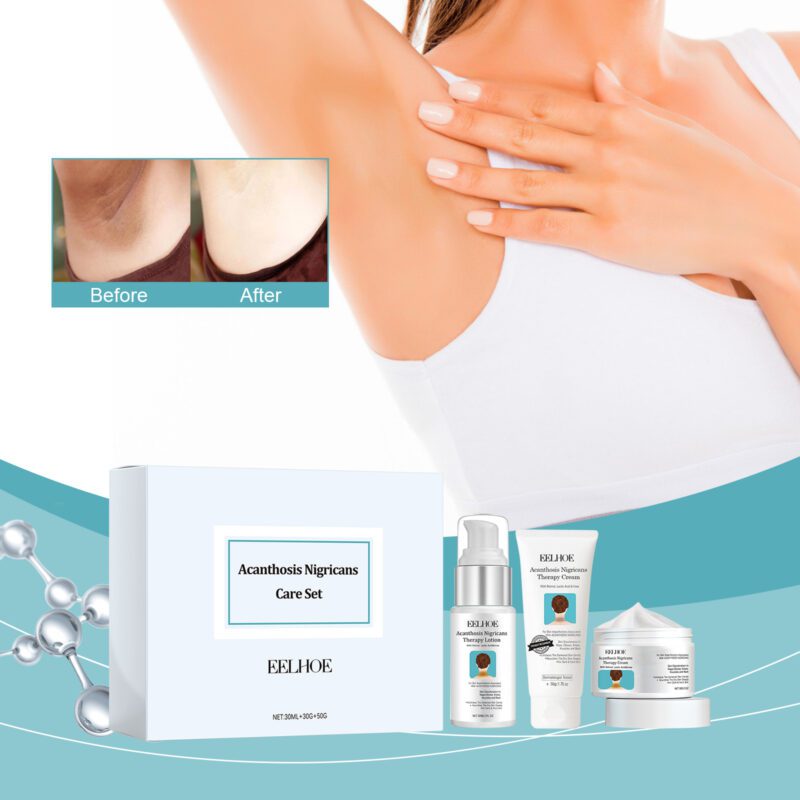 EELHOE Daily Nurture Cream - Moisturize Brighten Knees, Arms - Image 2