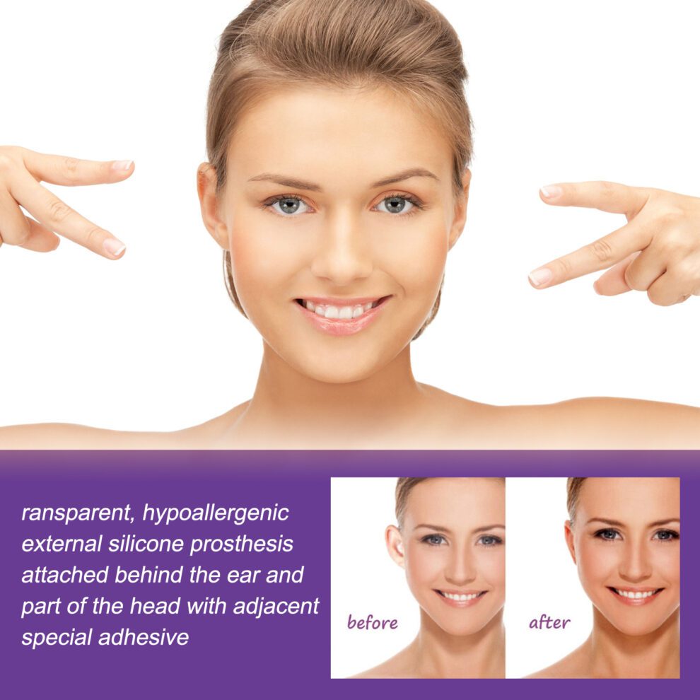 EELHOE Ear Stickers - Gentle Silicone Daily Care for Natural Ear Look - Image 4