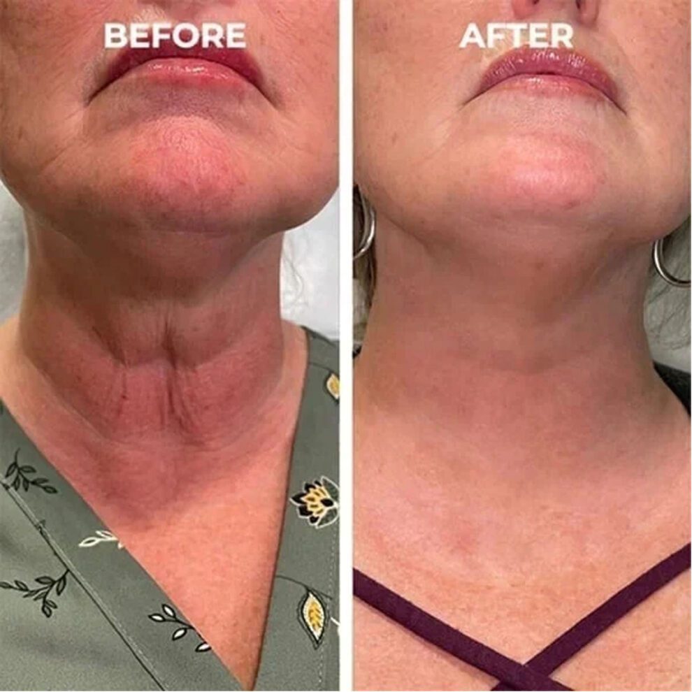 EELHOE Facial Essence: Daily Natural Hydration for Glowing Skin - Image 4