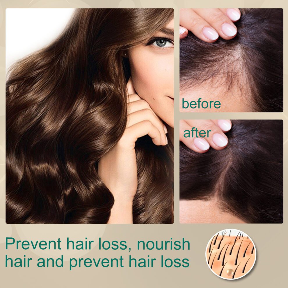 EELHOE Ginger Hair Cream - Gentle Daily Scalp Care, Soft & Nourished - Image 4