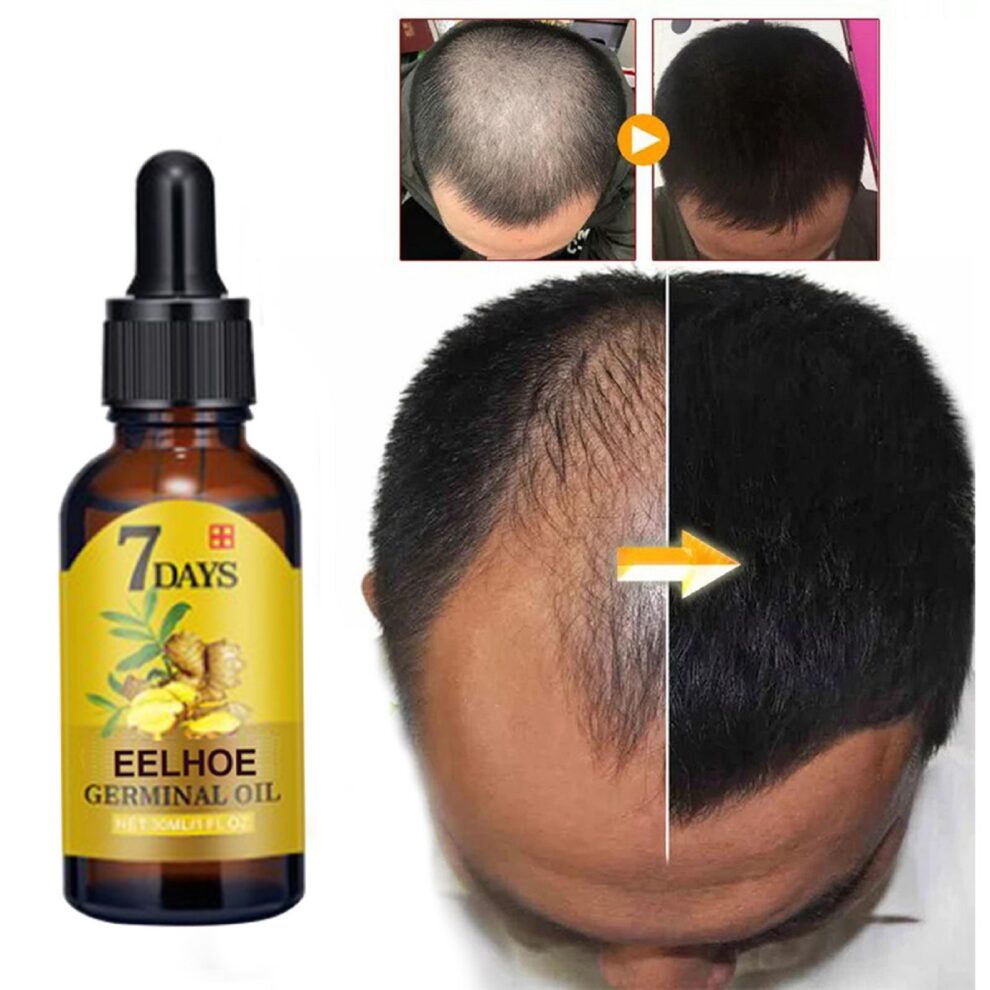 EELHOE Ginger Hair Essence: Gentle Daily Care for Soft, Fluffy Hair (40ml) - Image 4