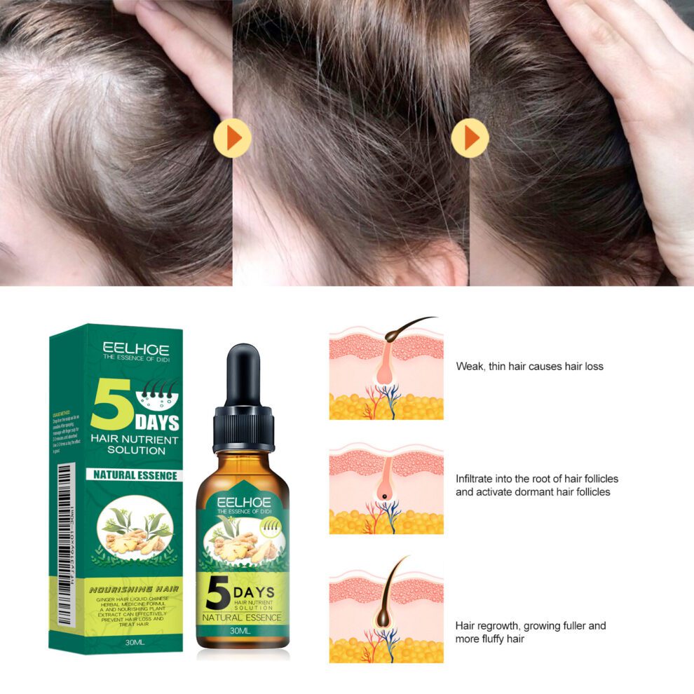 EELHOE Ginger Hair Oil - Daily Care for Soft, Shiny Tresses - Image 4
