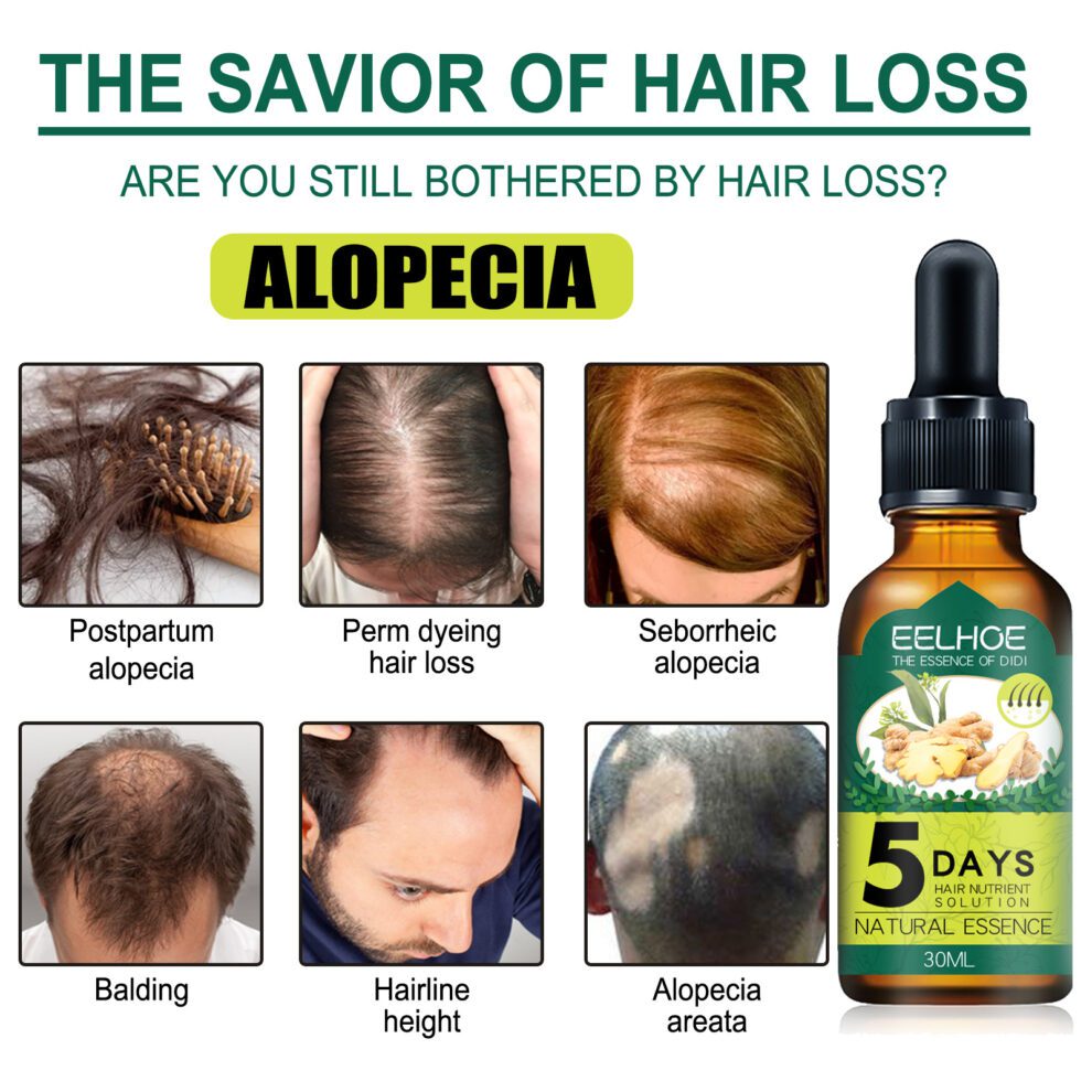 EELHOE Ginger Hair Oil - Daily Care for Soft, Shiny Tresses - Image 5