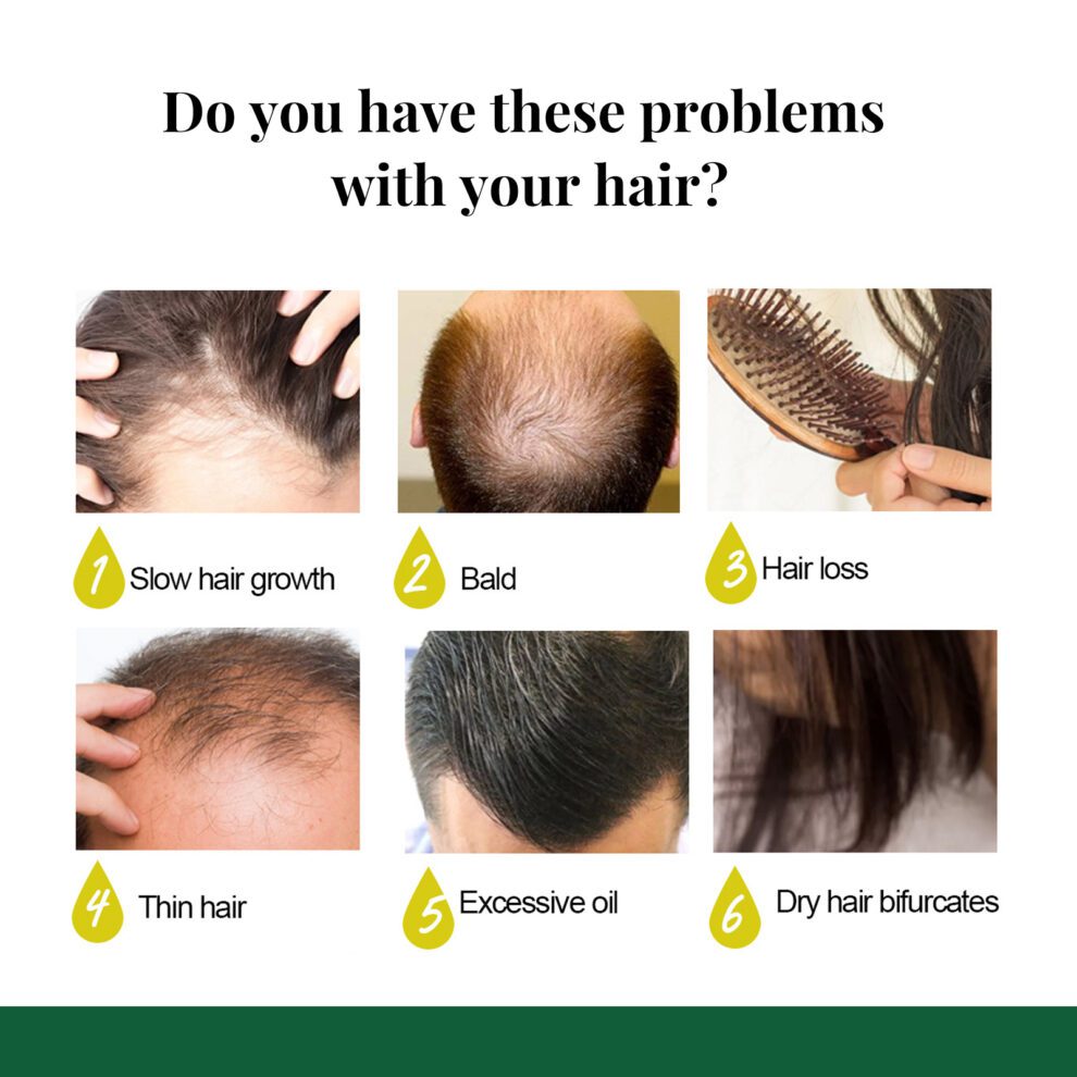 EELHOE Ginger Hair Spray - Daily Care for Happy Hair (50ml) - Image 3
