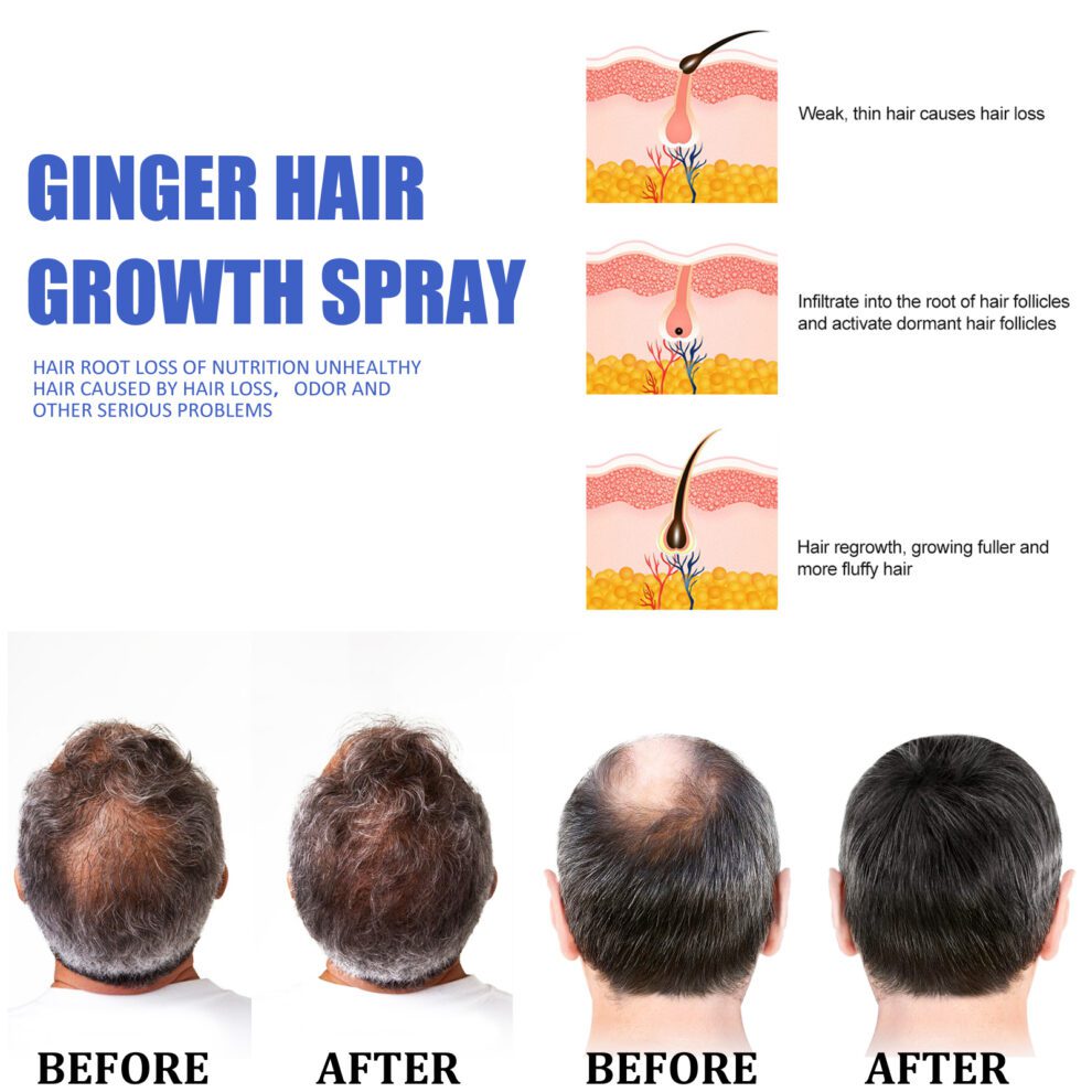 EELHOE Ginger Hair Spray: Gentle Daily Care for Soft Shiny Hair - Image 4
