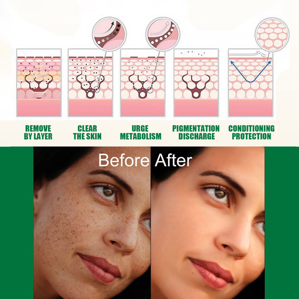 EELHOE Natural Brightening Essence - Daily Glow, Hydrate & Radiant Skin - Image 4