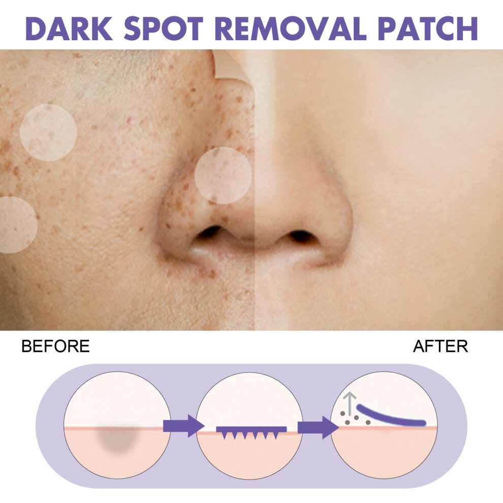 EELHOE Natural Brightening Face Patches - Daily Care for Radiant Glow - Image 4
