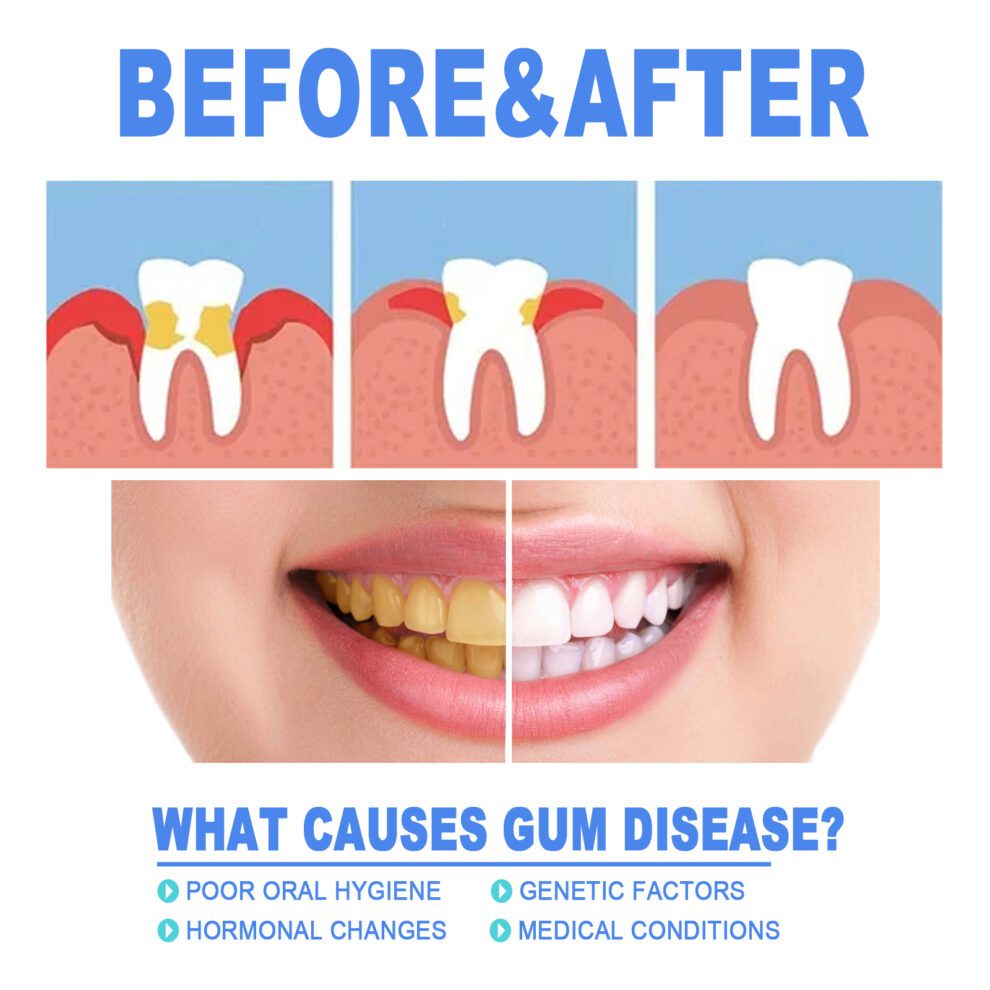 EELHOE Natural Daily Dental Gel for Fresh Smile & Gentle Care - Image 4