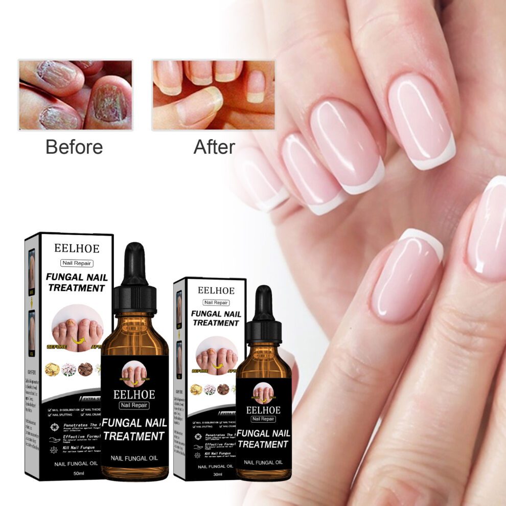 EELHOE Natural Nail Care - Gentle Nourish, Healthy Glow - Image 2
