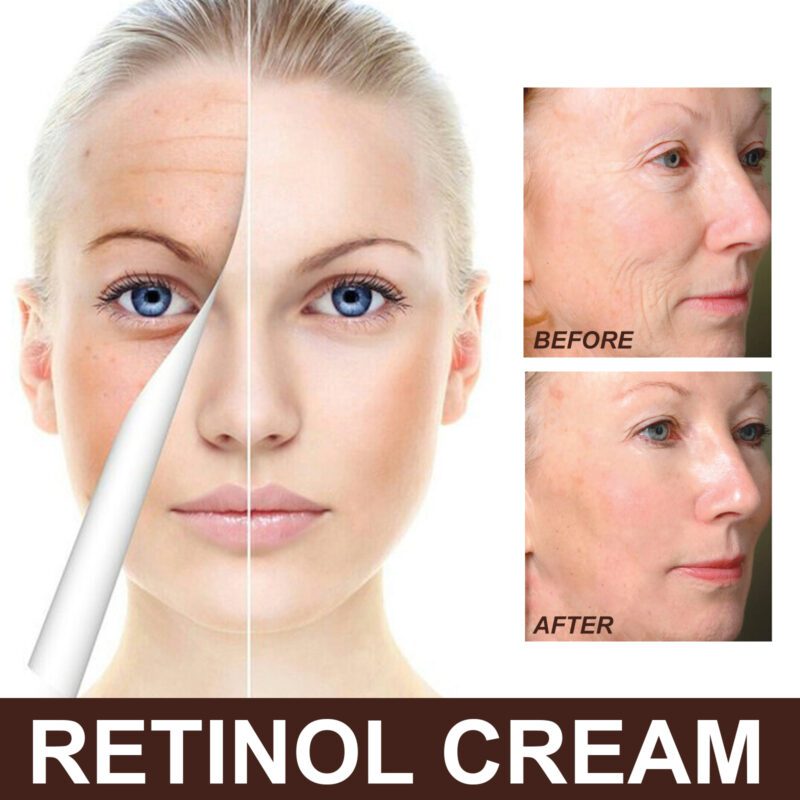 EELHOE Natural Retinol Cream - Daily Hydrating Brightening Face Care - Image 2