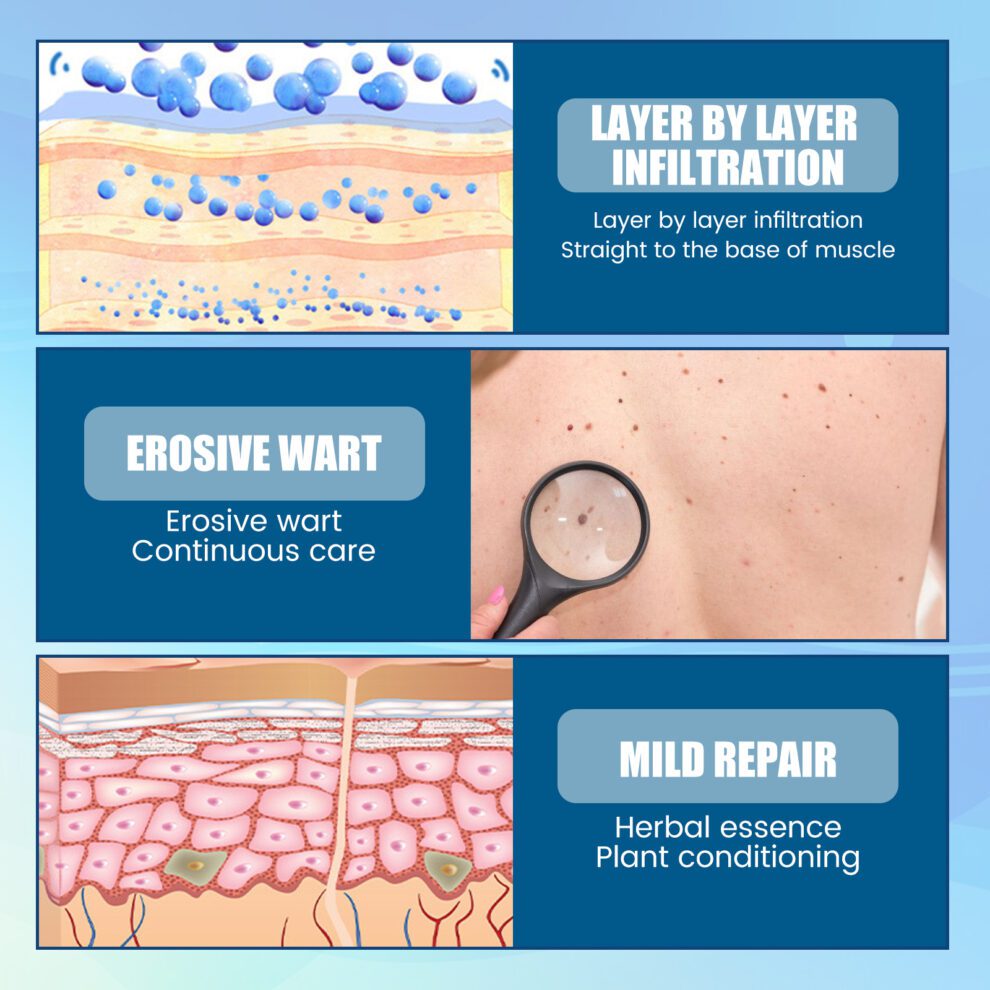 EELHOE Natural Skin Care Stickers - Gentle Nourish & Improve Daily - Image 3