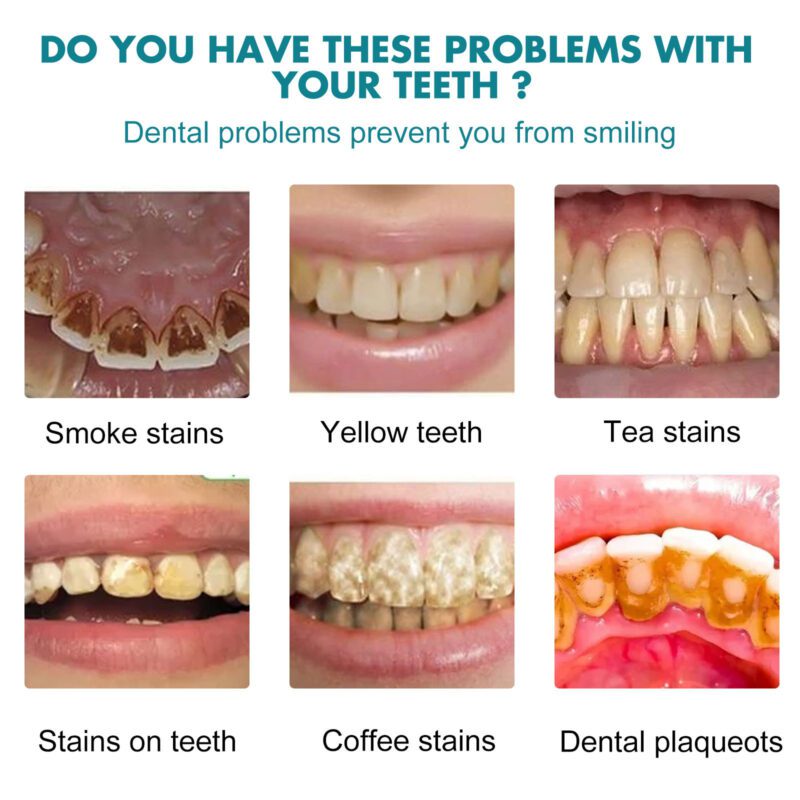 EELHOE Natural Teeth Whitening Paint - Bright Smile Daily Care - Image 3