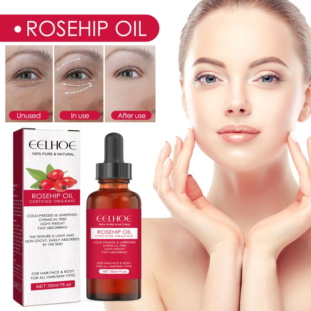 EELHOE Rose Hip Essential Oil - Daily Nourish for Face Body Hair | Gentle Care - Image 2