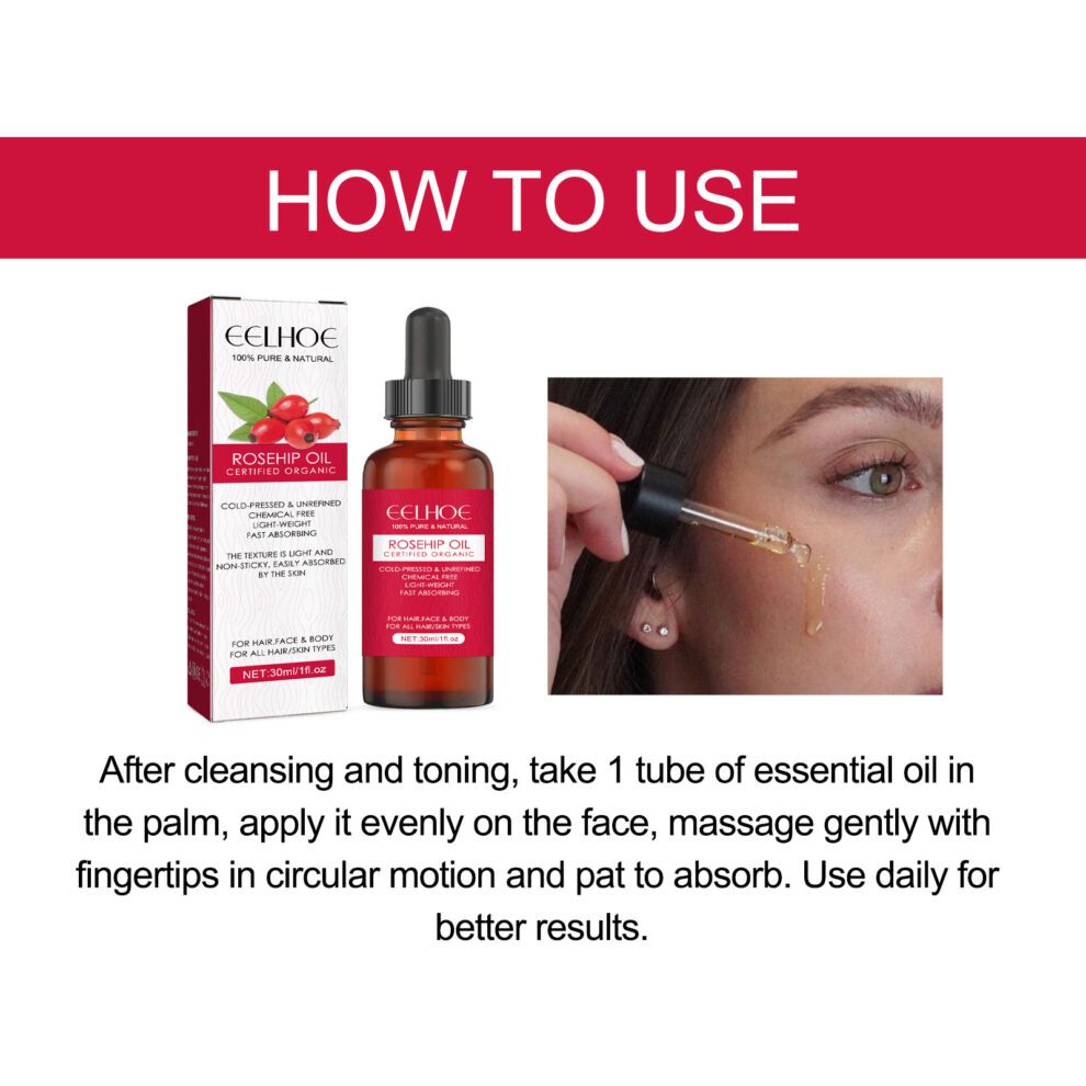 EELHOE Rose Hip Essential Oil - Daily Nourish for Face Body Hair | Gentle Care - Image 6