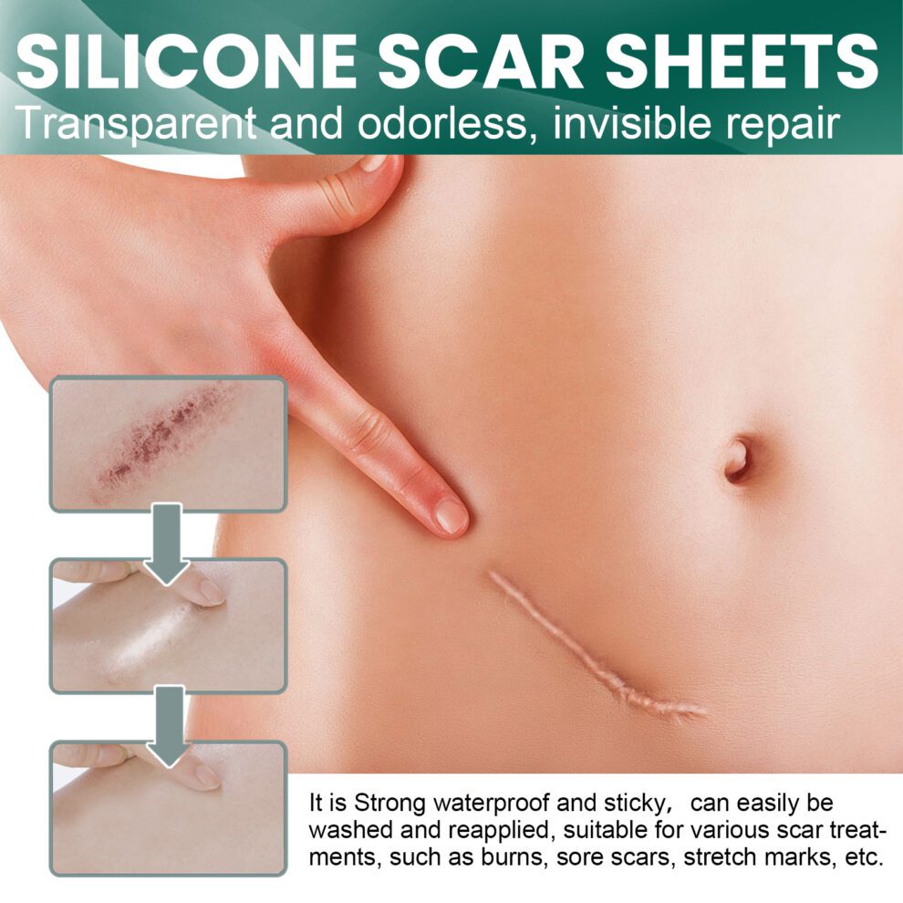 EELHOE Silicone Scar Care Patch - Gentle Daily Nurture & Invisible - Image 3
