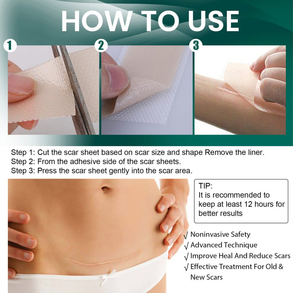 EELHOE Silicone Scar Care Patch - Gentle Daily Nurture & Invisible - Image 5
