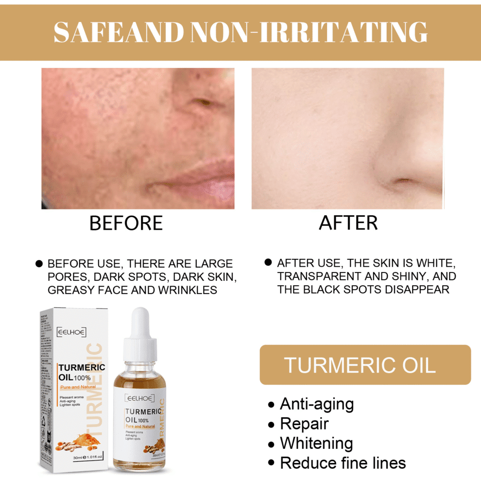 EELHOE Turmeric Daily Care Essence - Gentle Hydration & Glow - Image 4