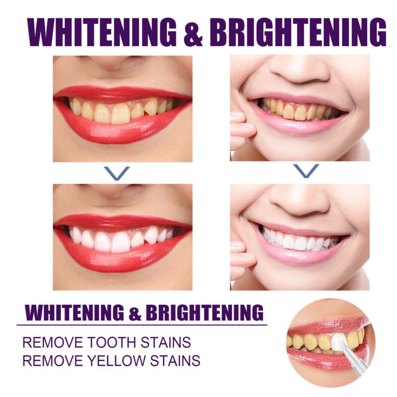EELHOE V34 Purple Dental Pen: Daily Care for Natural Bright Smiles - Image 4