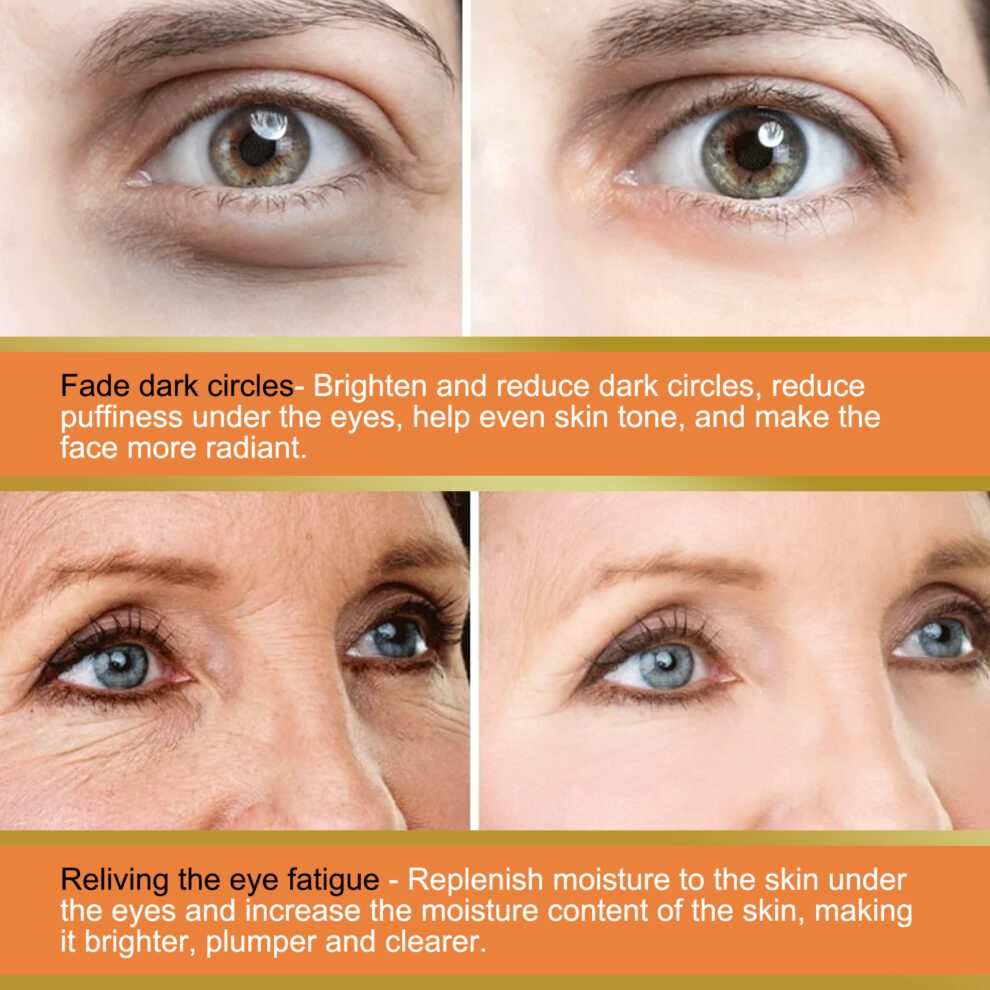 EELHOE Vitamin C Eye Balm – Daily Glow, Nourish & Brighten - Image 3