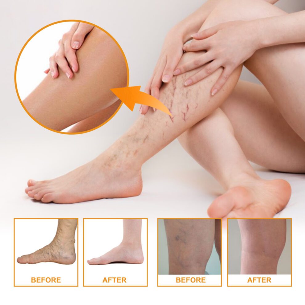 EELHOE Vitamin K Cream - Gentle Daily Leg Care with Natural Nourishment - Image 3