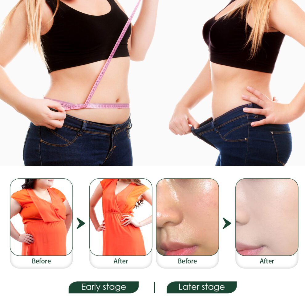 Eelhoe Natural Belly Patch: Daily Care for Glow & Slim - Image 4