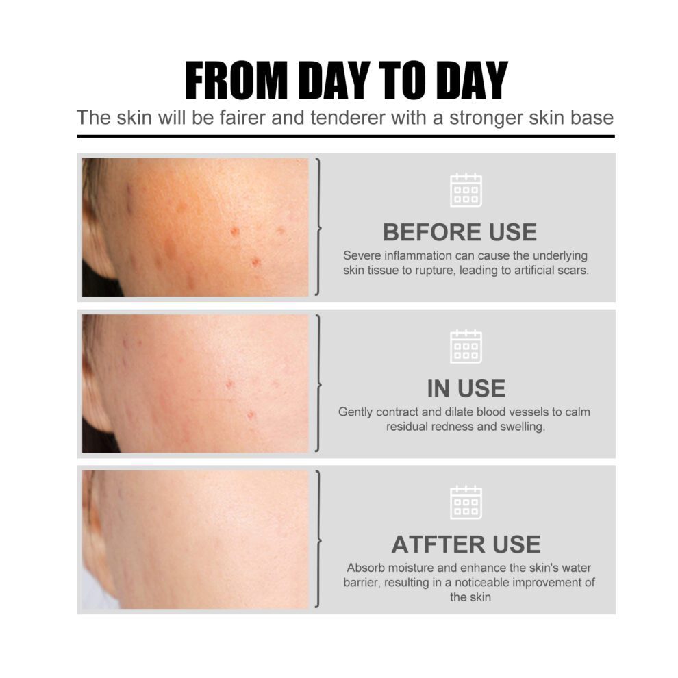 Gentle Natural Face Essence - Daily Care for Glowing, Smooth Skin - Image 4