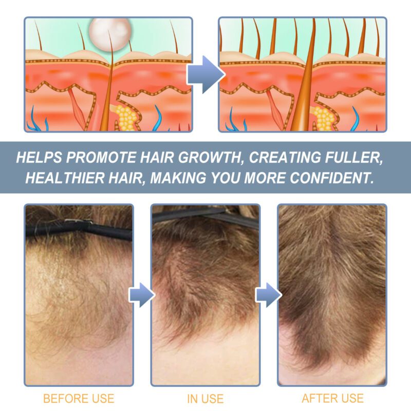 Hoegoa Natural Hair Scrub: Gentle Daily Nourish Care - Image 4