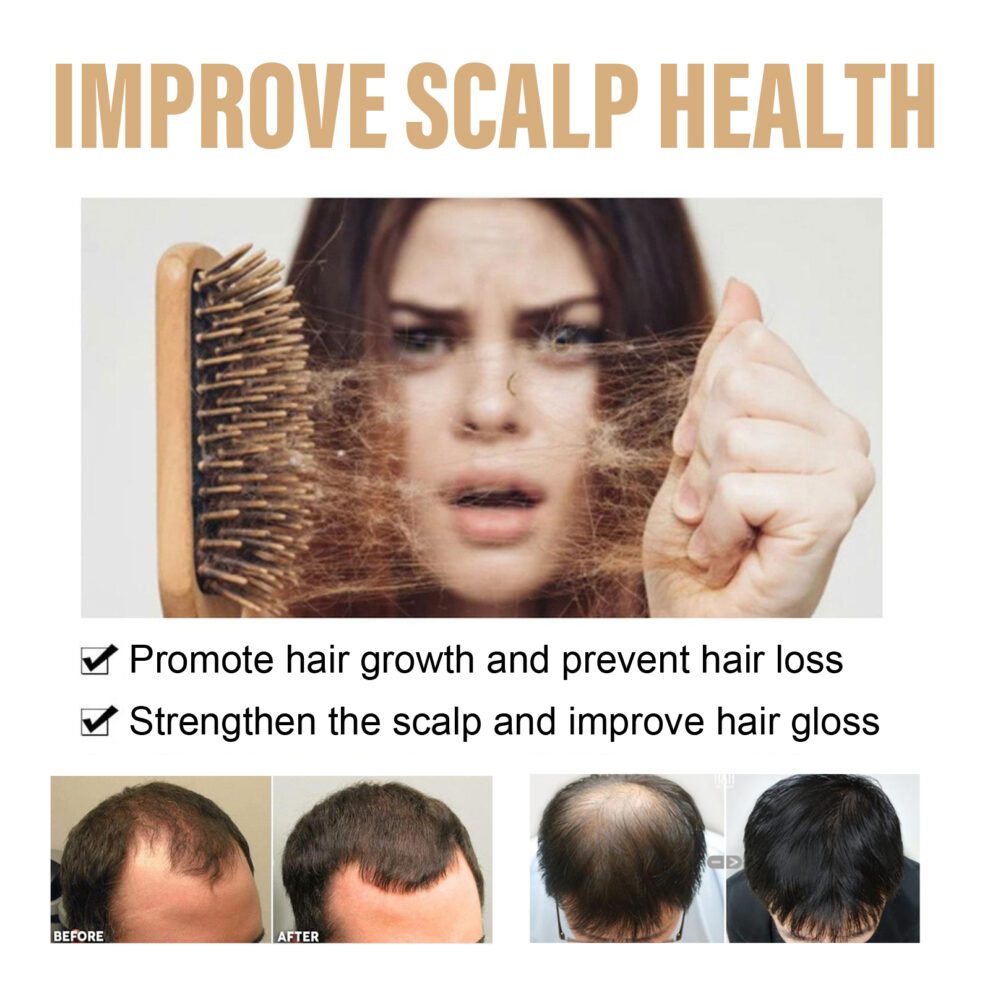 Hoegoa Natural Shampoo: Gentle Daily Care for Fluffy Soft Hair - Image 3