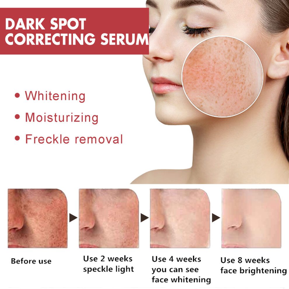 Hoygi Dark Spots Care Essence - Brightening Moisturizing Daily Glow - Image 3