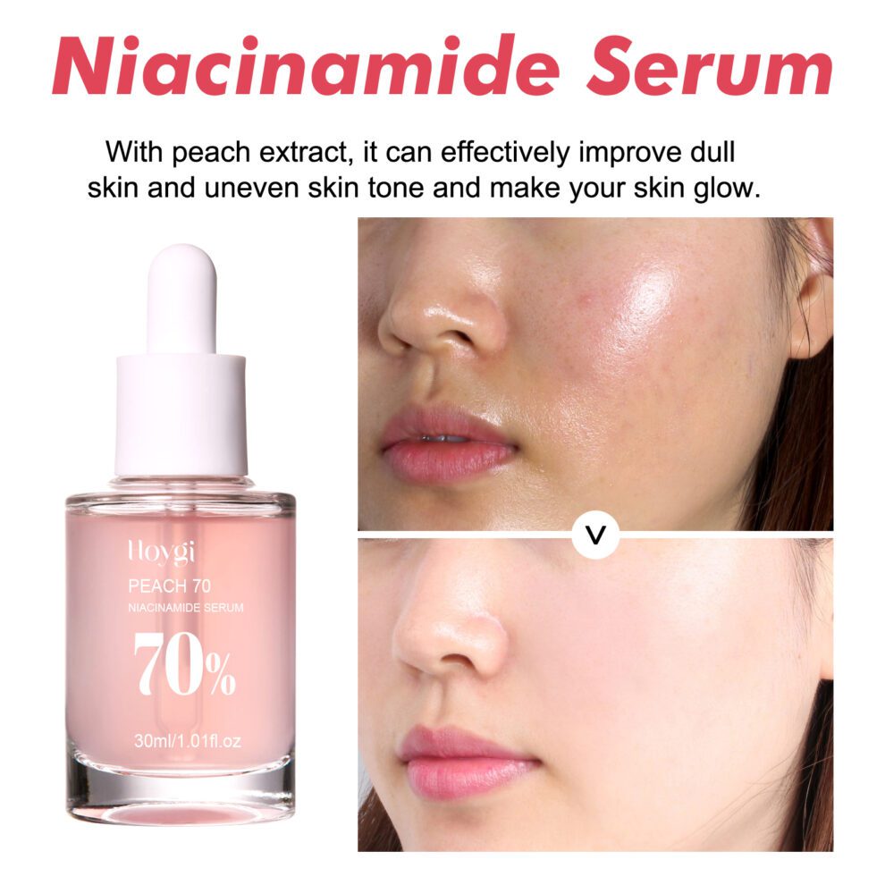 Hoygi Niacinamide Essence: Gentle Daily Glow, Natural Hydration & Brightening - Image 3