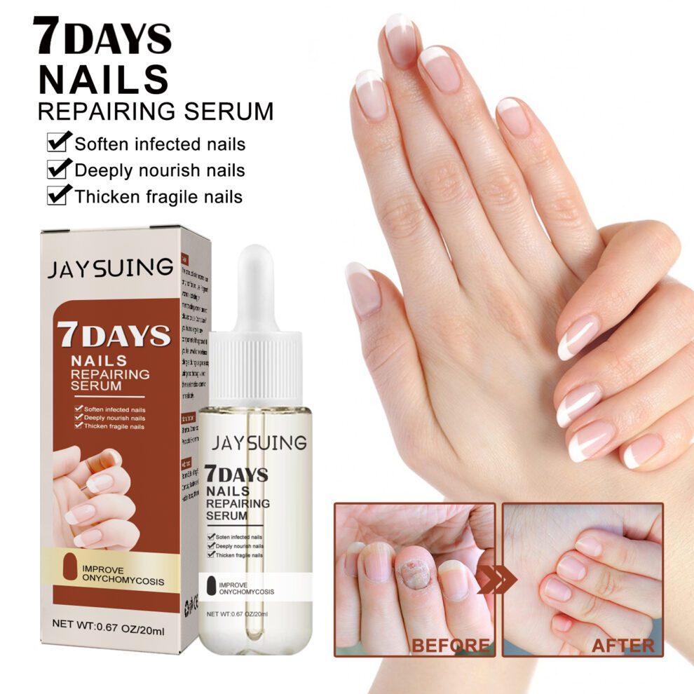 Jaysuing 7-Day Natural Nail Care Essence - Gentle Daily Hand & Foot Nourishment - Image 2