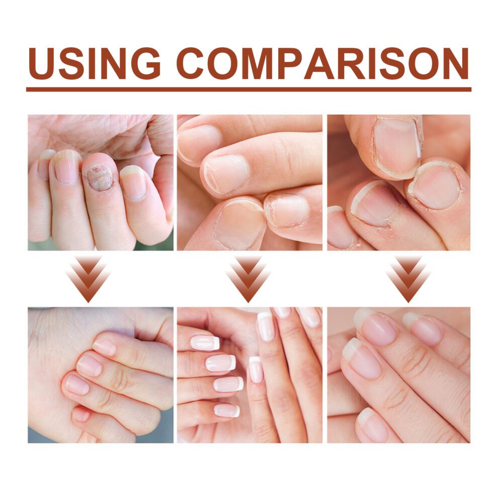 Jaysuing 7-Day Natural Nail Care Essence - Gentle Daily Hand & Foot Nourishment - Image 3