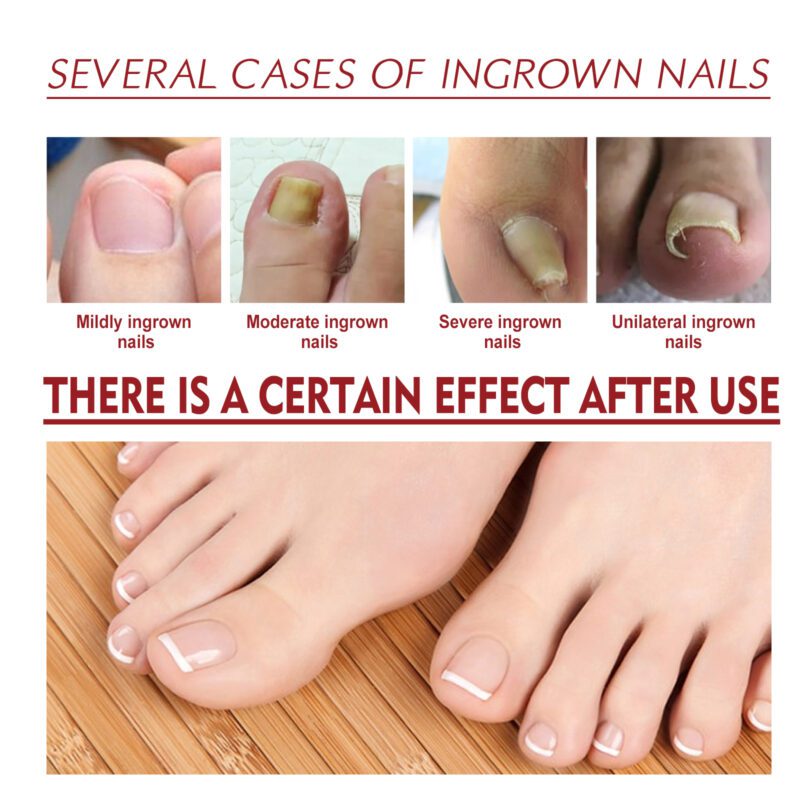 Jaysuing Daily Nourish Natural Nail Oil - Soft Shiny Nails - Image 3
