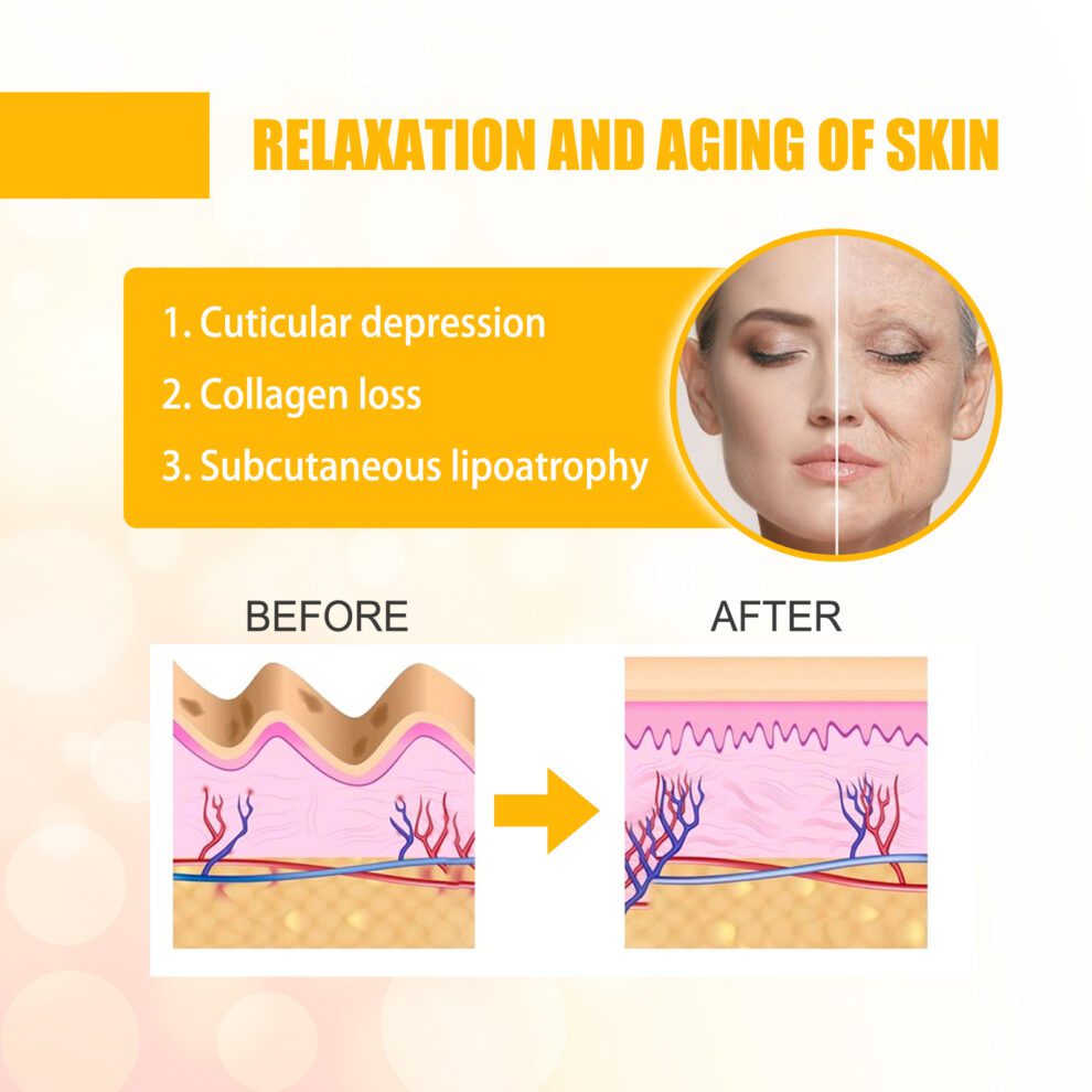 Jaysuing Natural Collagen Smile Line Patch - Daily Care for Glow - Image 4