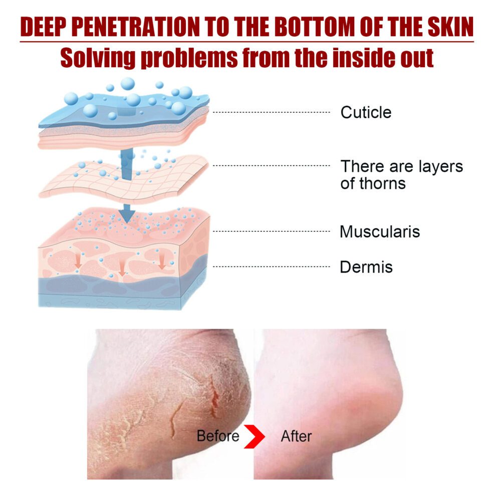 Jaysuing Natural Foot Mask - Soft Feet Daily Care with Gentle Nurture - Image 4
