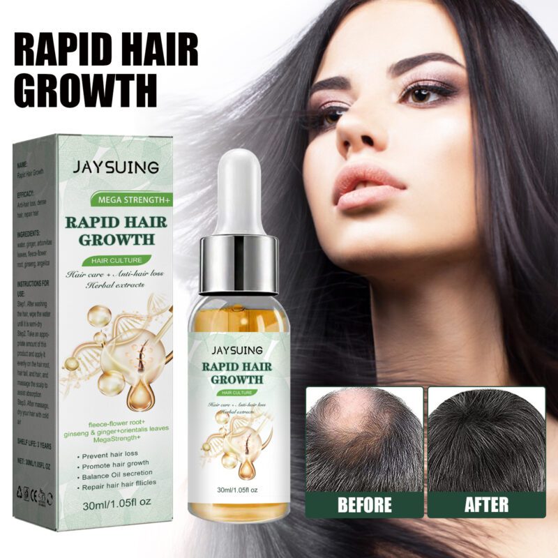 Jaysuing Natural Ginger Hair Serum - Daily Care for Thicker, Happier Hair - Image 2