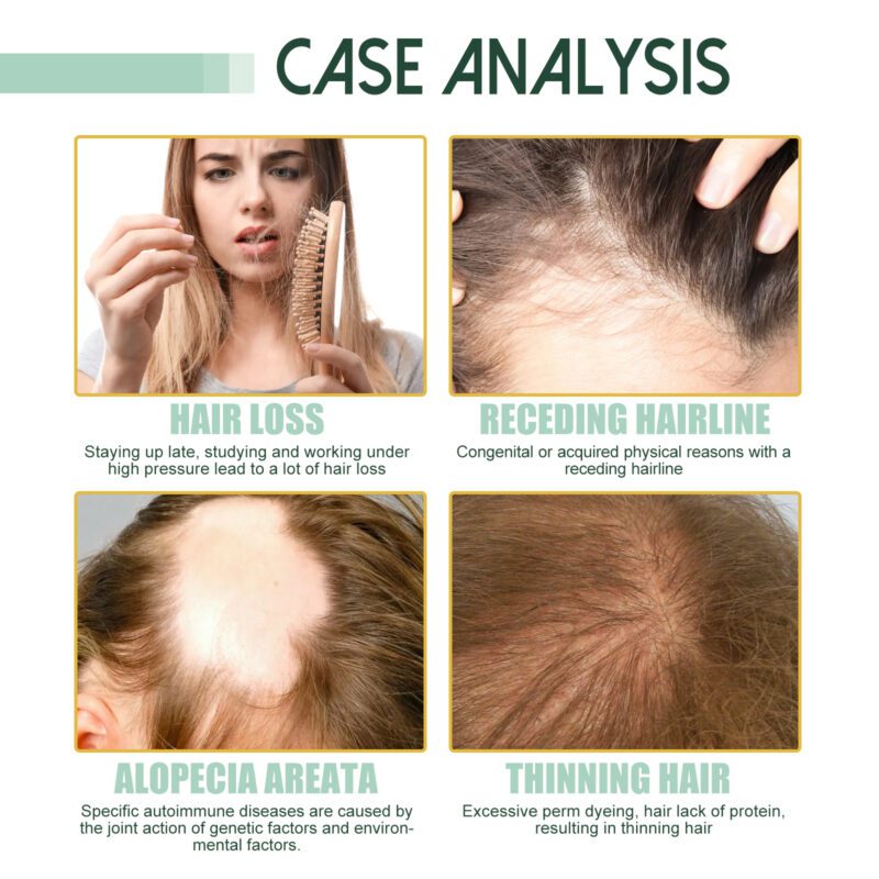 Jaysuing Natural Ginger Hair Serum - Daily Care for Thicker, Happier Hair - Image 3