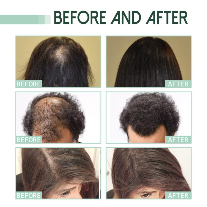Jaysuing Natural Ginger Hair Serum - Daily Care for Thicker, Happier Hair - Image 4