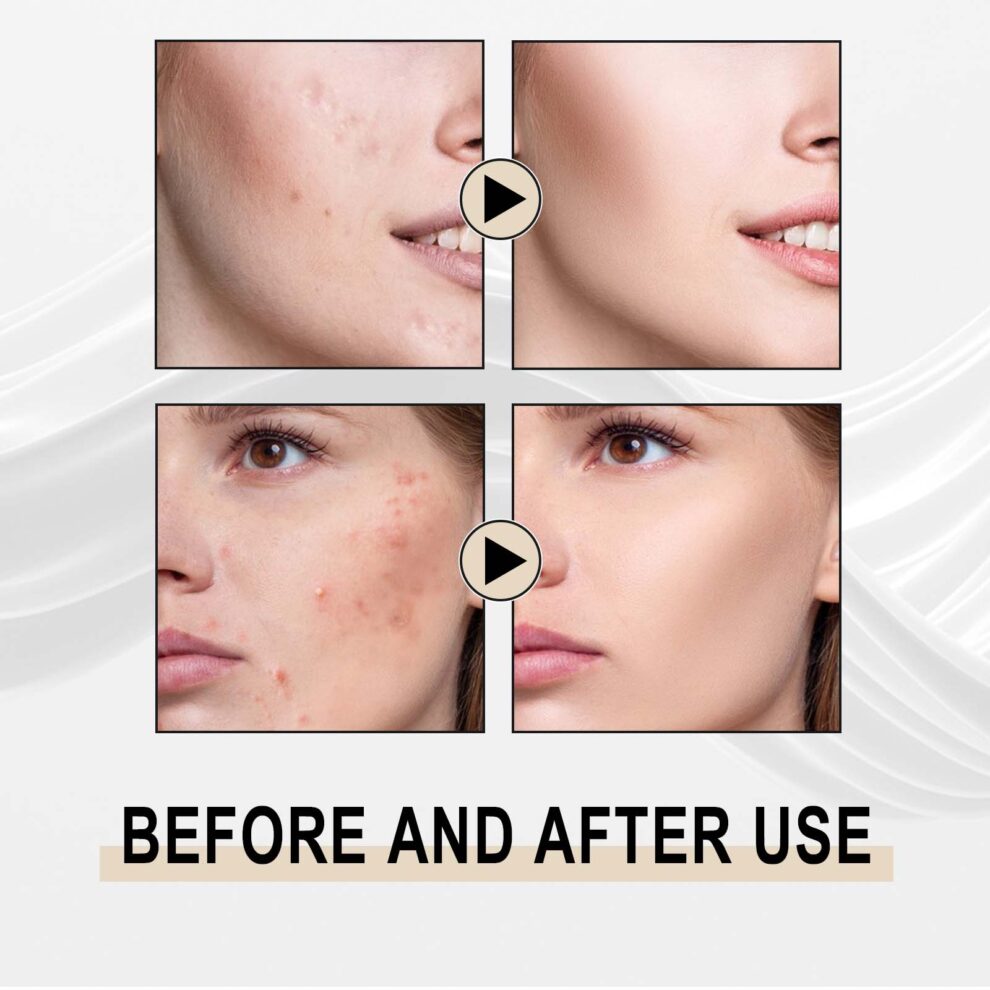 Jaysuing Natural Lactose Essence - Gentle Daily Care for Soft Glowing Skin - Image 4