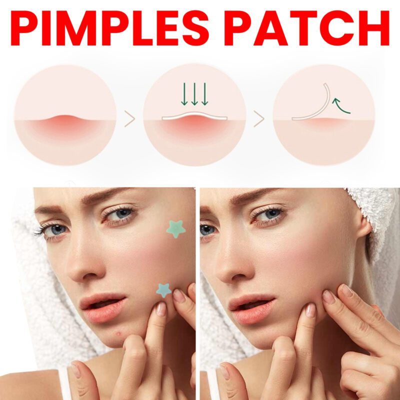 Jaysuing Pimple Patches - Natural Daily Care for Clear Skin - Image 4