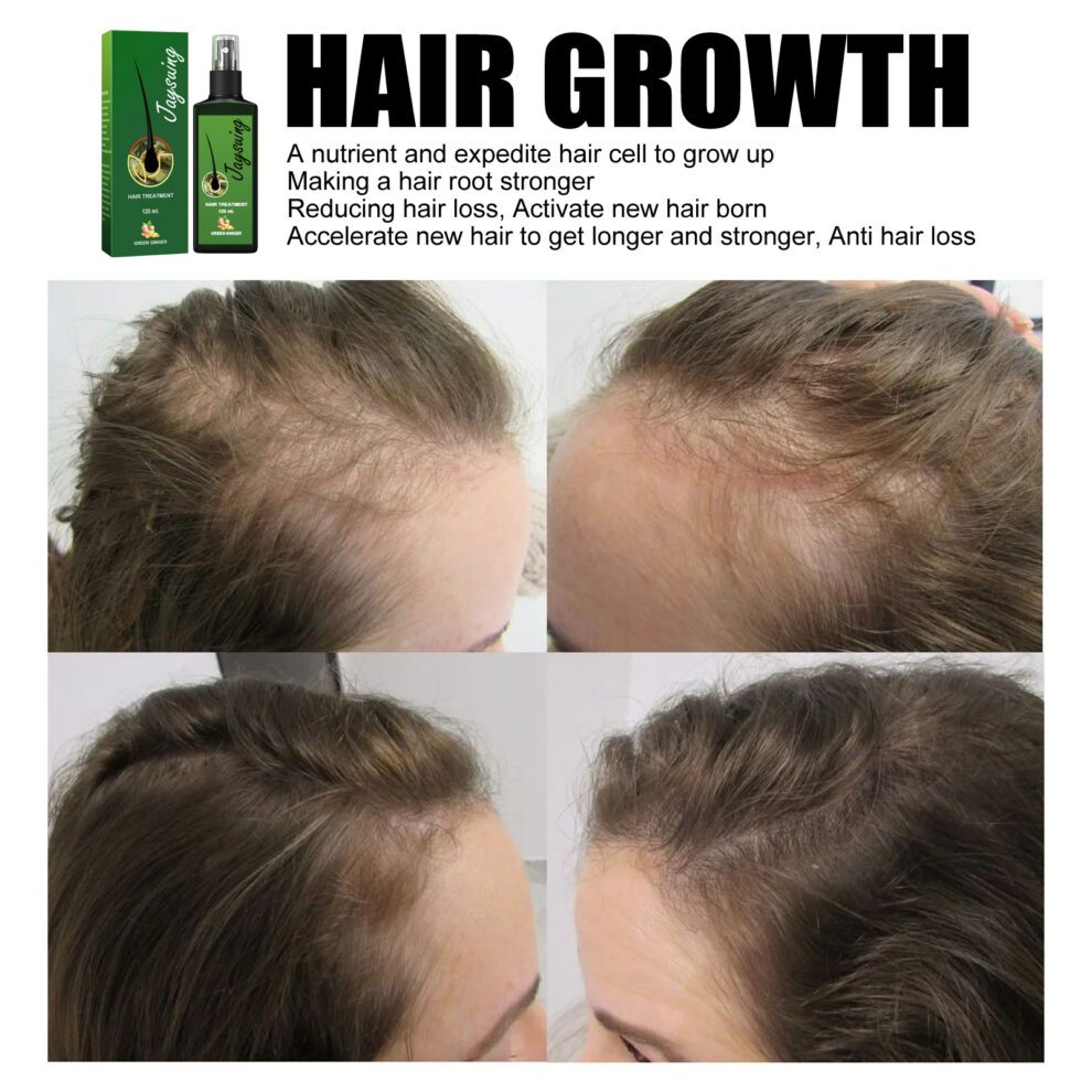 Jaysuing Scalp & Hair Care Spray - Gentle Daily Nourish, Soften & Love - Image 3
