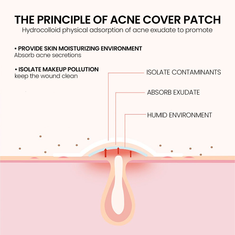 Jaysuing Soothing Pimple Patches - Natural Daily Care - Image 4