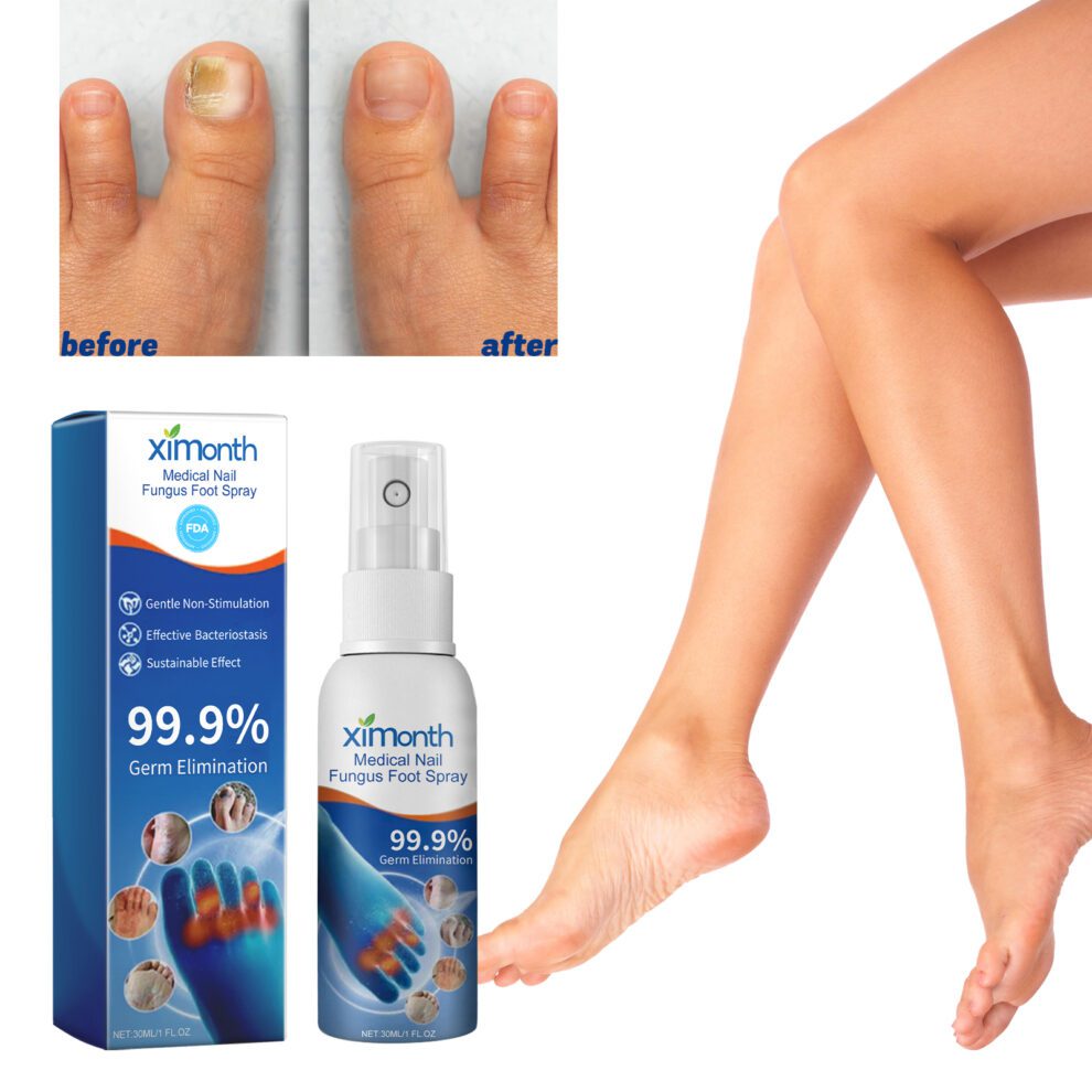 Natural Foot & Nail Care Spray - Soothing Plant Extracts Daily - Image 2