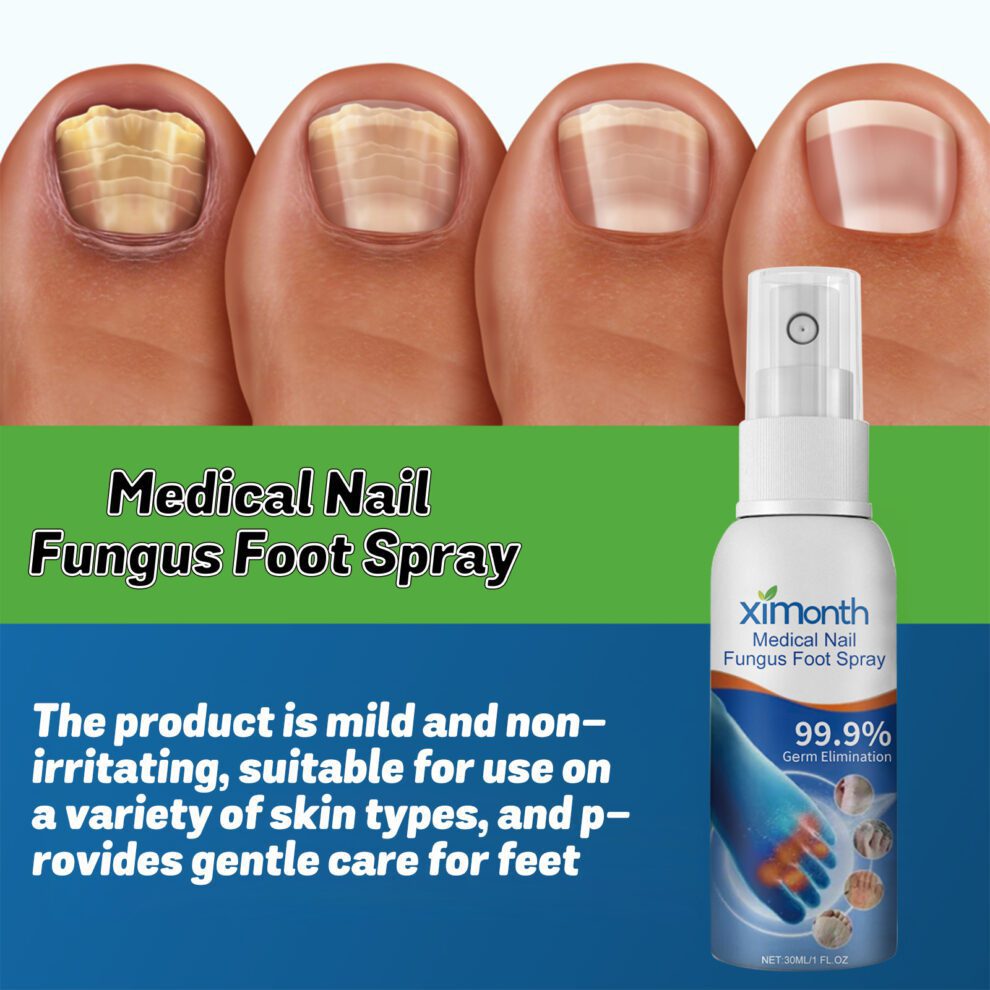 Natural Foot & Nail Care Spray - Soothing Plant Extracts Daily - Image 4