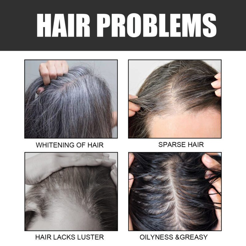 OUHOE Black Hair Soap - Natural Daily Care for Shiny Tresses - Image 3
