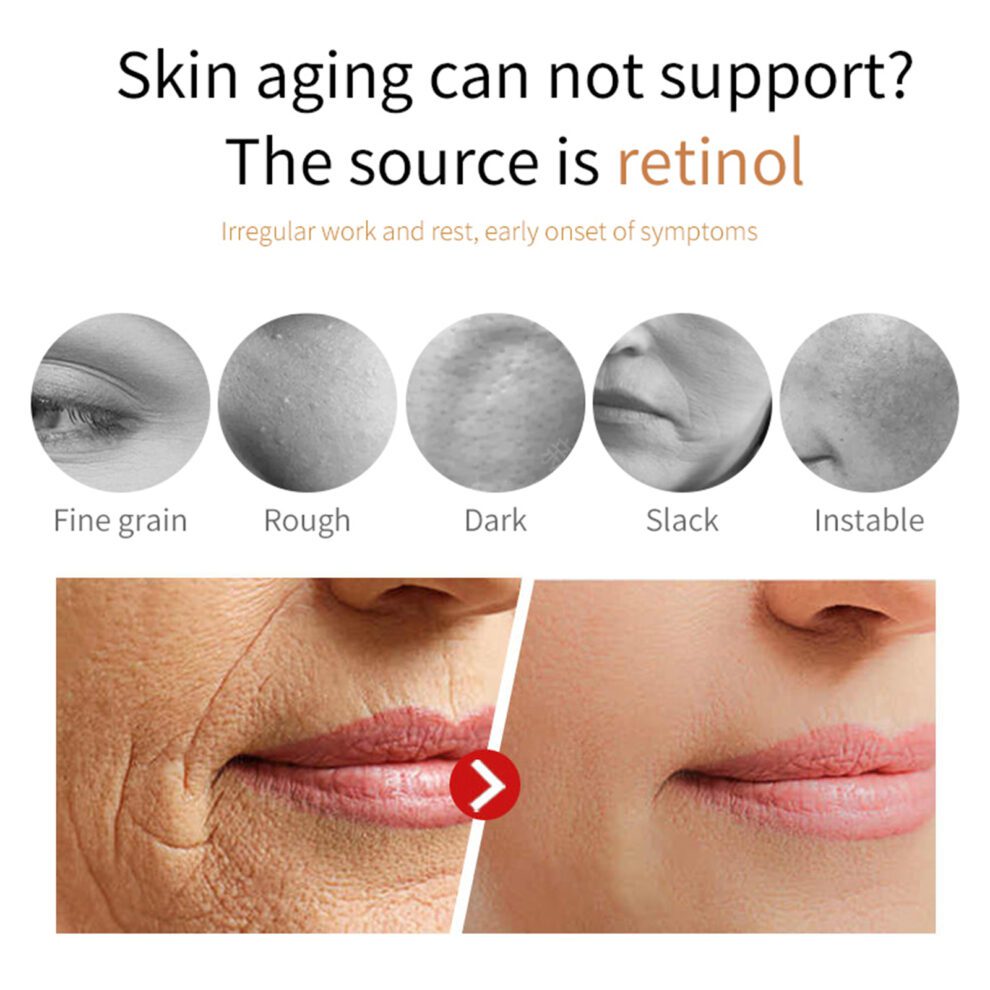 OUHOE Dragon Blood Cream - Daily Hydration for Radiant, Glowing Skin - Image 3